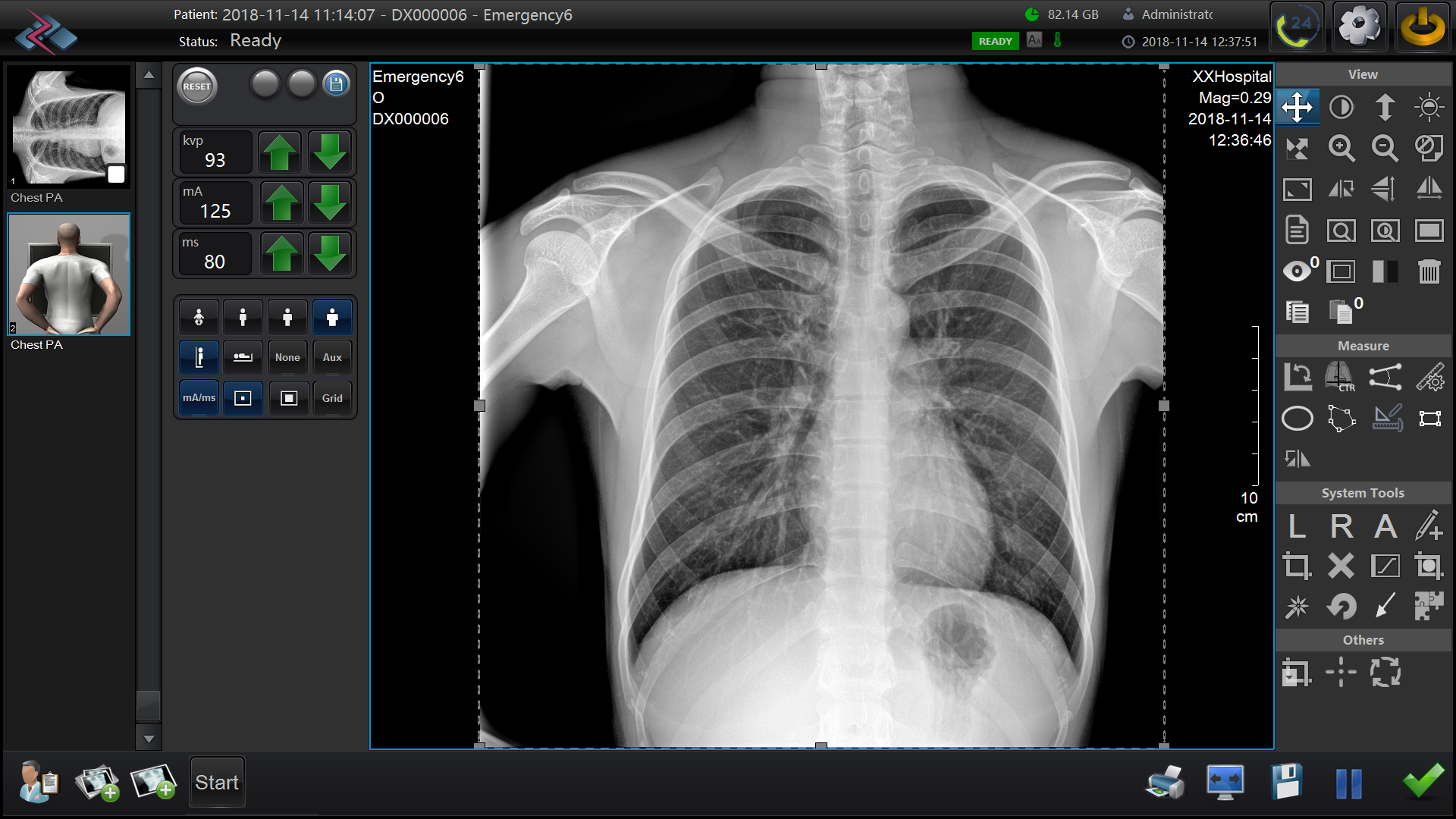 Как выбрать плоскопанельный детектор для цифровой рентгенографии?